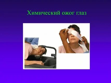 Ожоги глаз тест нмо