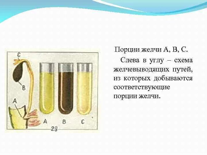 Дуоденальное зондирование желчного пузыря у детей. Исследование дуоденального содержимого. Дуоденальное содержимое микроскопическое исследование. Цвет порции а дуоденального содержимого.