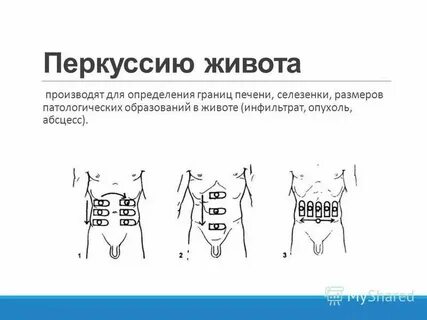 Перкуссия живота
