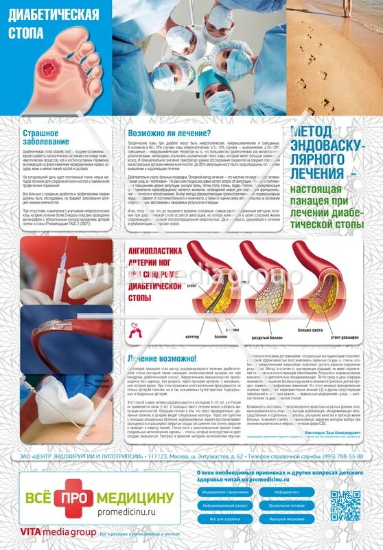 Диабетическая стопа рекомендации. Профилактика диабетической стопы. Профилактика диабетической стопы памятка.