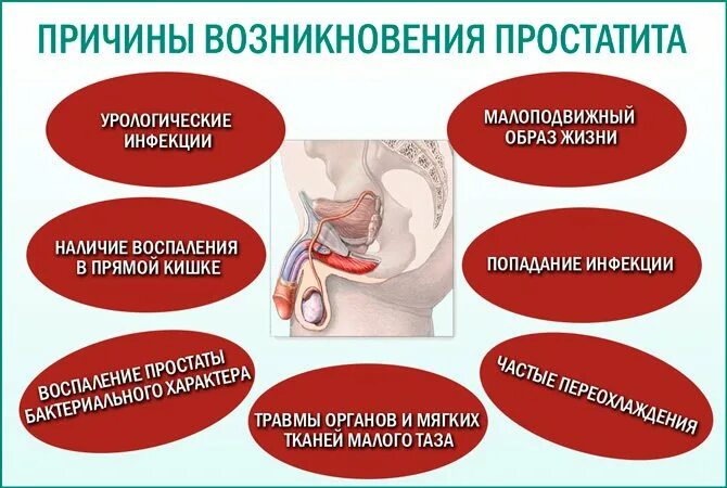 Простатиты у мужчин признаки симптомы ощущения. Причины возникновения простатита. причины простатита у мужчин. простатиты у мужчин причины возникновения.
