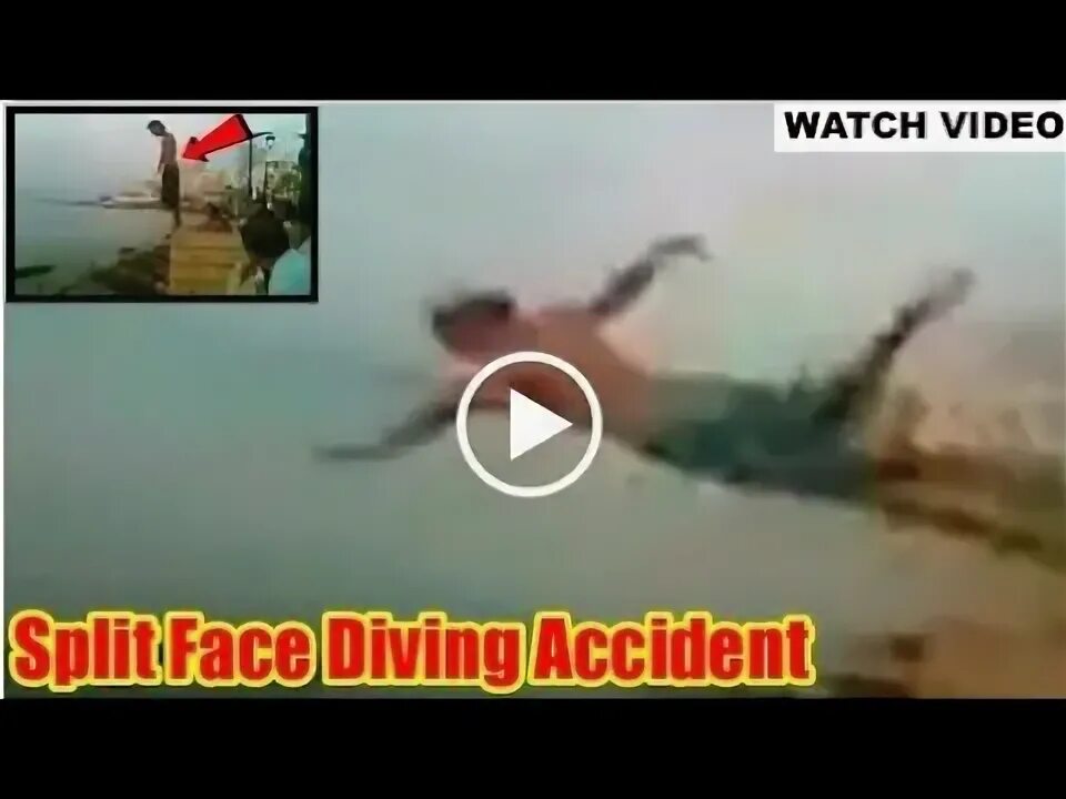 Diving face split. Split face diving accident на русском.