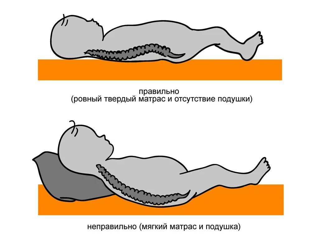 Как правильно спать. Правильная поза для сна без подушки. Положение спины на матрасе. Правильная поза для сна детям. Сплю без матраса