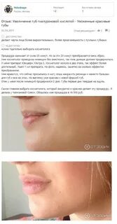 Гиалуроновая кислота для губ названия