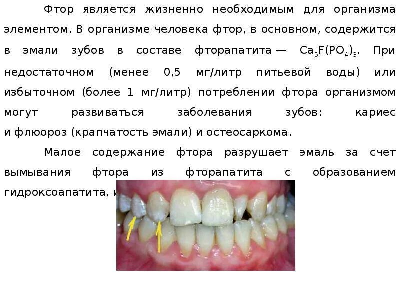 Недостаток фтора может привести к развитию. Избыток фтора в организме. фтор содержание в организме. содержание фтора в организме человека. заболевания при избытке фтора.