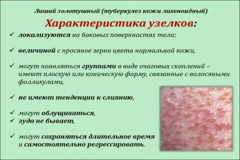 Болезнь часто писать