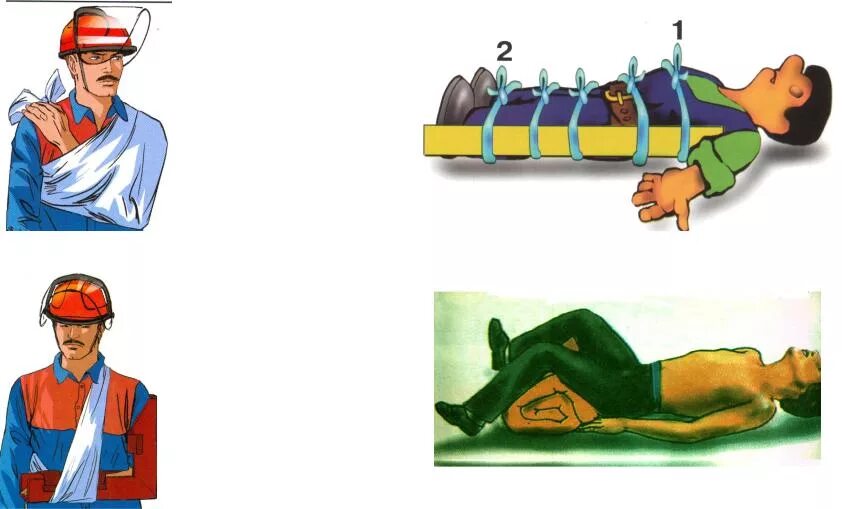 Рассмотрите рисунок иллюстрирующий прием первой помощи. Первая помощь при массовых поражениях людей. Особенности оказания первой помощи при массовом поражении. Первая помощь при поражении обвалах. Оказание первой помощи на поле боя.
