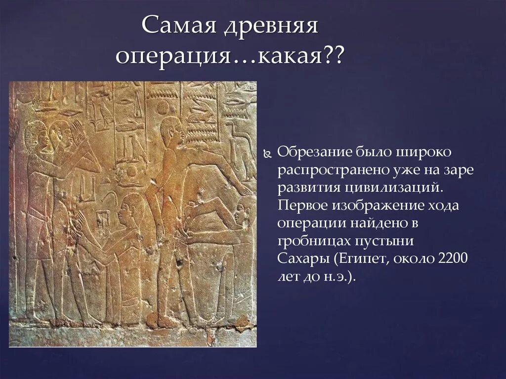 Что считается древностью. Самые древние операции. Самый древний. Какие операции считаются самыми древними. Самое древнее изображение операции.