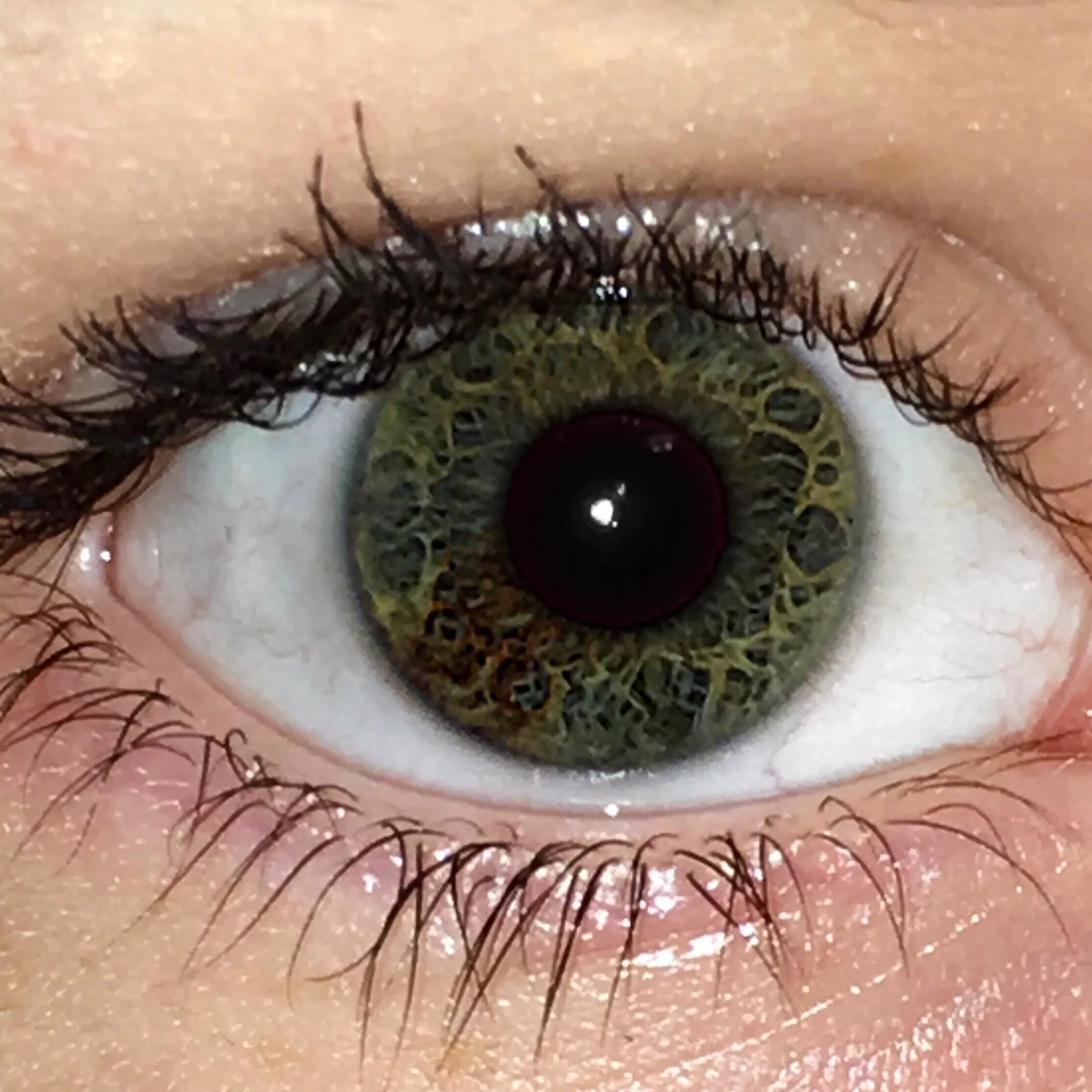 Гетерохромия радужной оболочки. Центральная гетерохромия карих глаз. Центральная гетерохромия зеленый Карий. Зелено карие глаза гетерохромия.