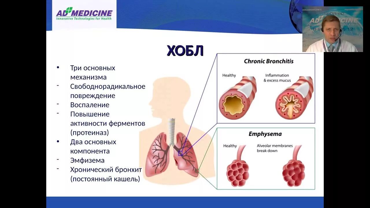 Бронхит хобл. ХОБЛ курильщика кашель. Хронический бронхит курильщика. Хронические болезни легких. Кашель бронхит курильщика.