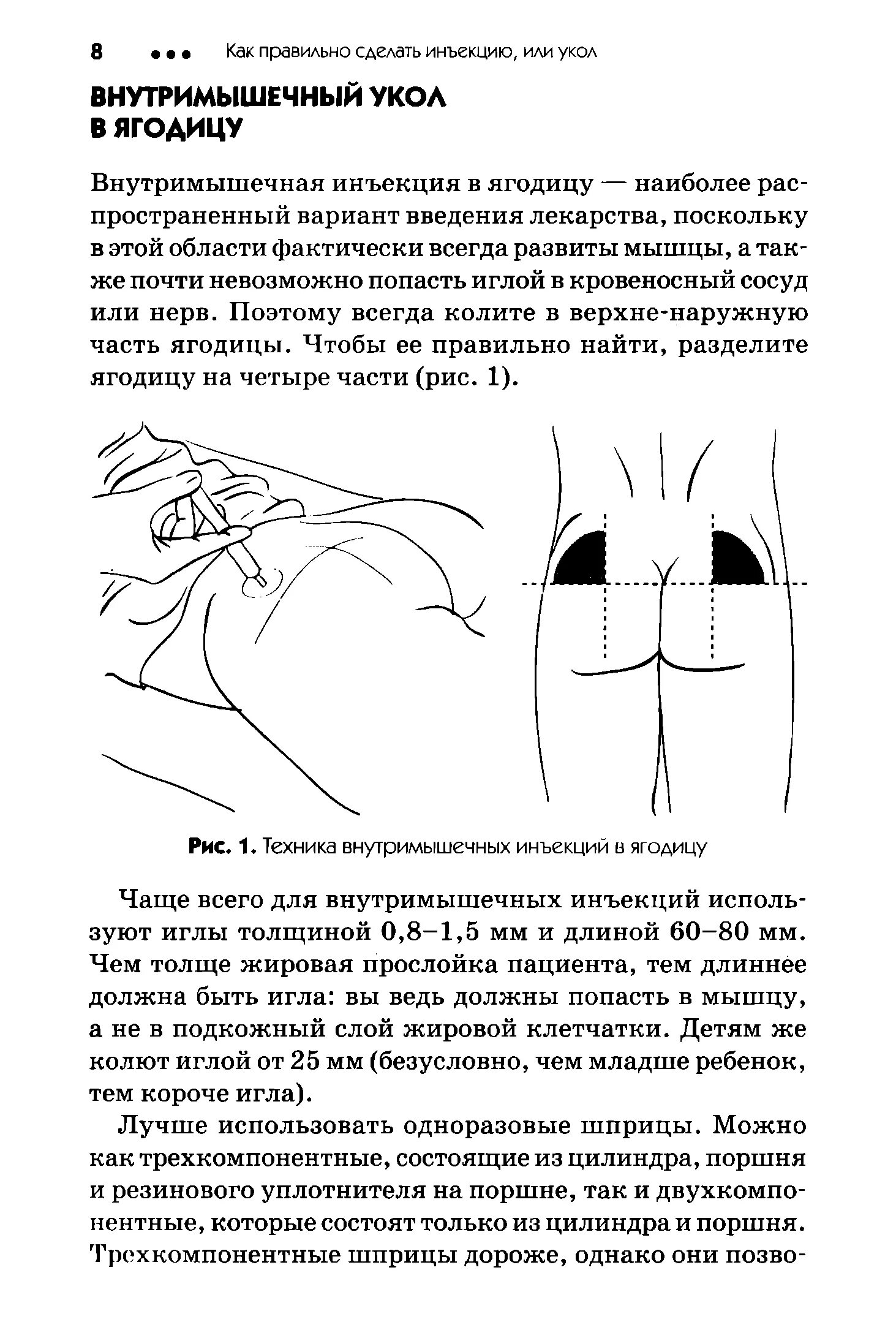 Ставить уколы дома. Как правильно сделать внутримышечный укол. Как правильно делать внутримышечный укол в ягодицу. Как сделать правильно укол в ягодицу взрослым. Как правильно сделать укол внутримышечно.