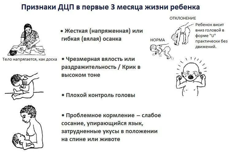 Как проявляется у детей симптомы. Симптомы дцп у грудничка в 2 месяца. ранние проявления дцп у детей до года. ранние признаки дцп у грудного ребенка до 3 месяцев. дцп симптомы у детей до 1 года.
