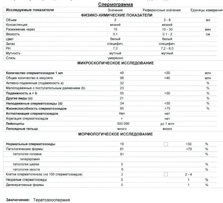 Нормальные формы спермограмма. Микроскопическое исследование спермограмма норма. патологии формы спермограмма. патология головки спермограмма норма. результат анализа расширенной спермограммы.