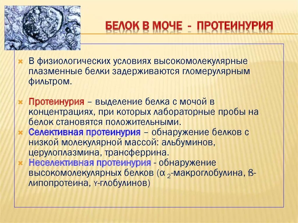 Протеинурия лечение. Белок в моче. Белок в моче причины. Препараты повышающие белок в моче. Белок в моче увеличен причины.