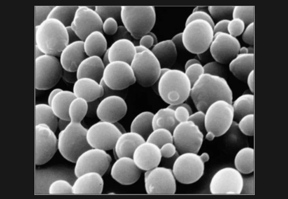 Дрожжи грибы. Yeast microscopy. Дрожи у женщин. Дрожжи строение. Дрожжевые грибы микробиология.