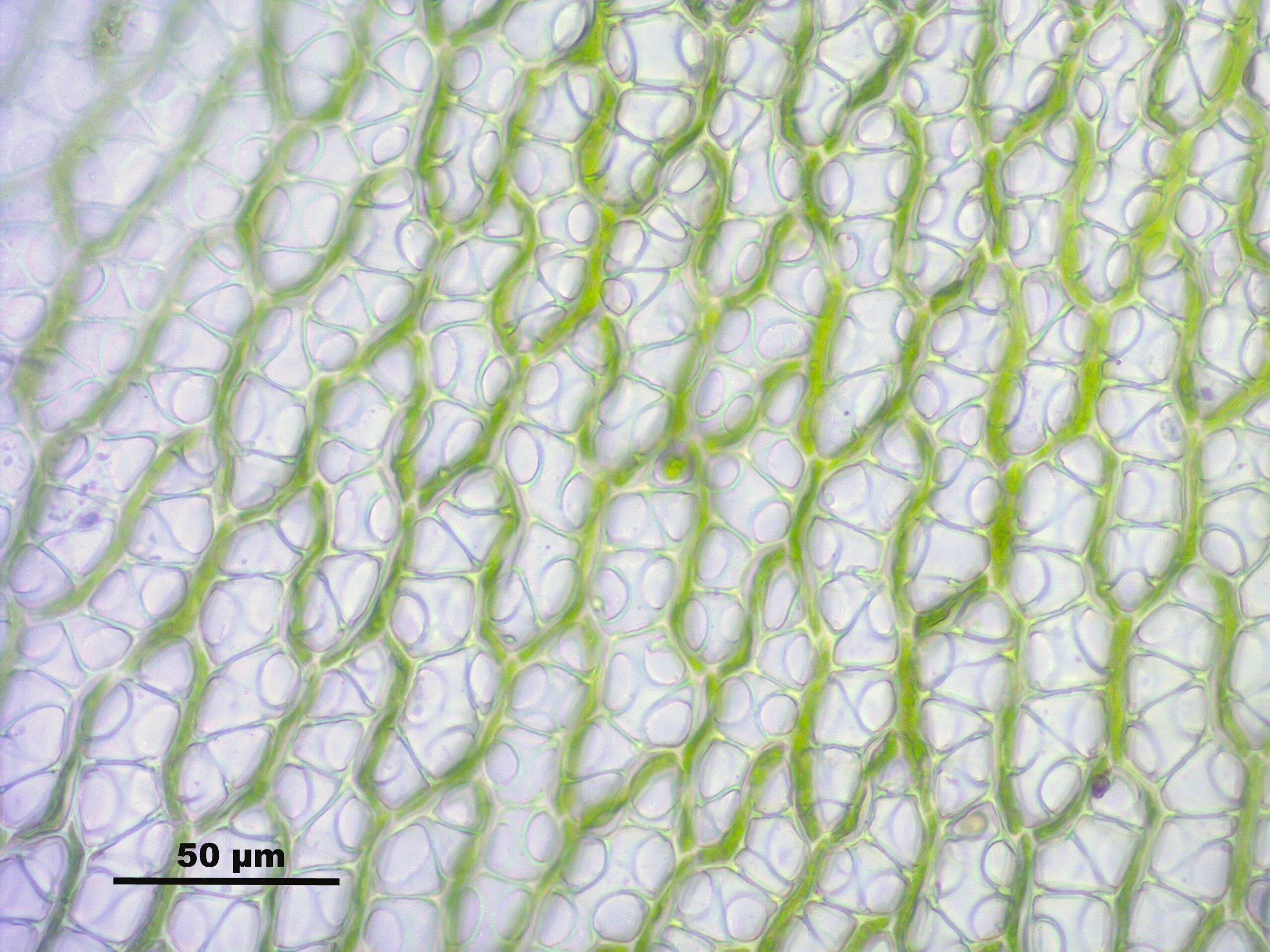 Водоносные клетки в листьях имеет. Клетки листа сфагнума. Хлорофиллоносные клетки сфагнума. Клетки листа сфагнума под микроскопом. Водоносная ткань сфагнума.