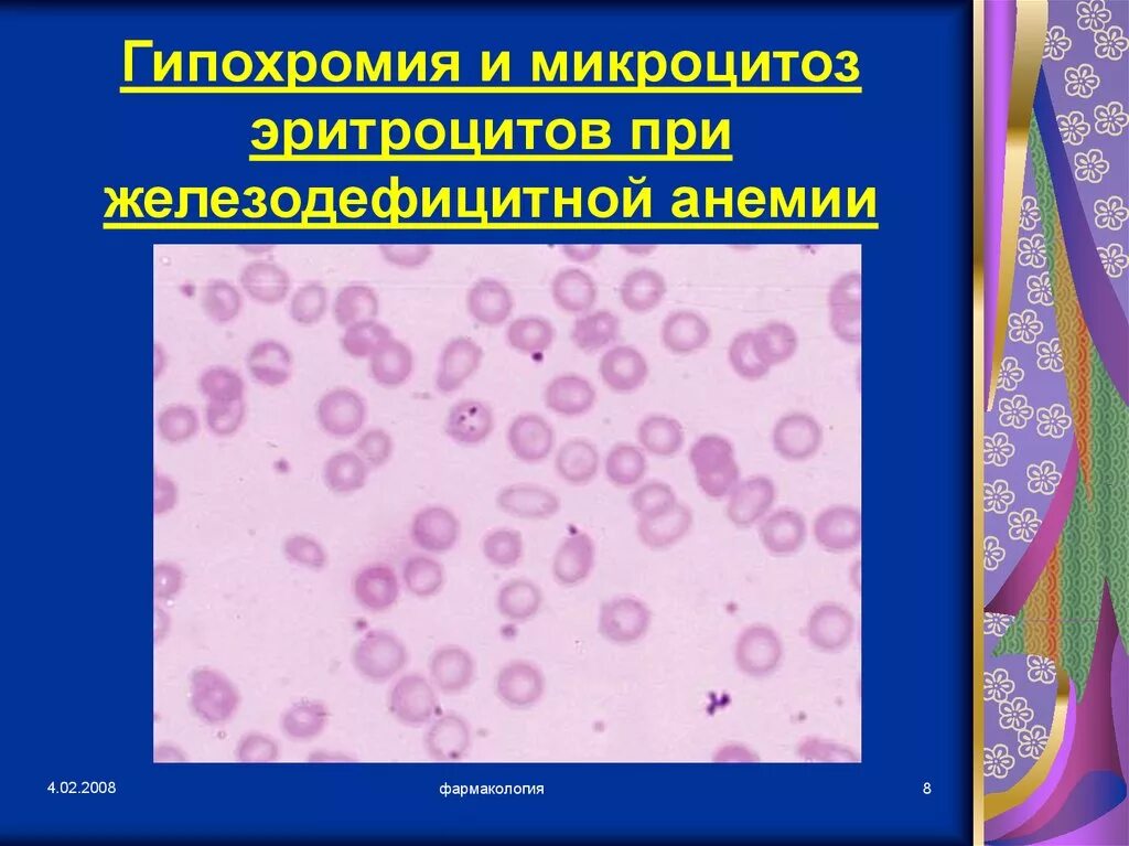 Гипохромия железодефицитная анемия. Микрохромна микроцитарная анемия. Микроцитарные эритроциты. Гипохромия микроцитоз. Анемия гипохромия микроцитоз.