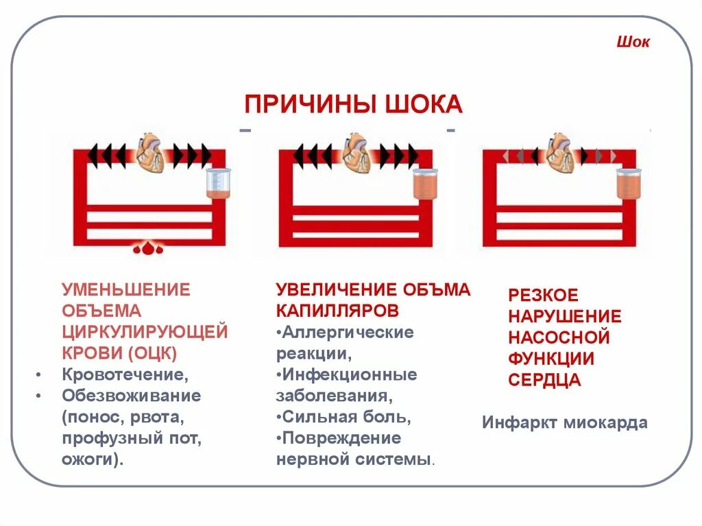 К причинам развития шока относятся. Причины развития шока патология. Причины шокового состояния. Причины развития шоковых состояний.