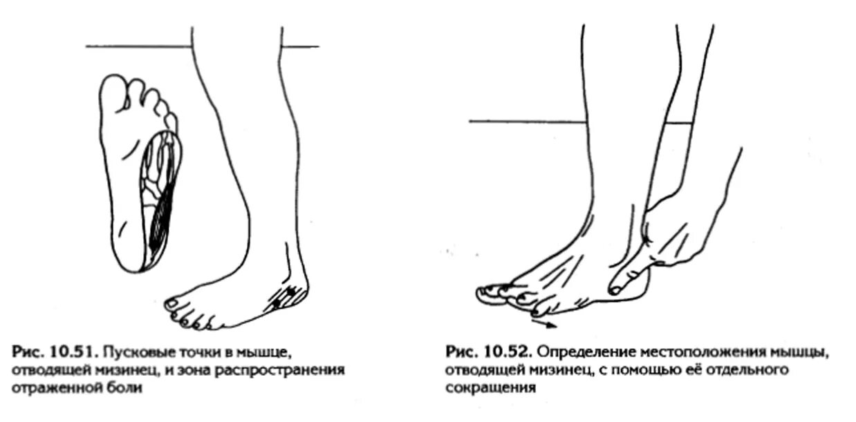 Болит внешняя сторона пятки. Боль в ноге ступня сбоку с внешней стороны. Боль в пятке сбоку с внешней стороны стопы. Болит стопа сбоку с внешней стороны. Болит ступня справа сбоку правая.