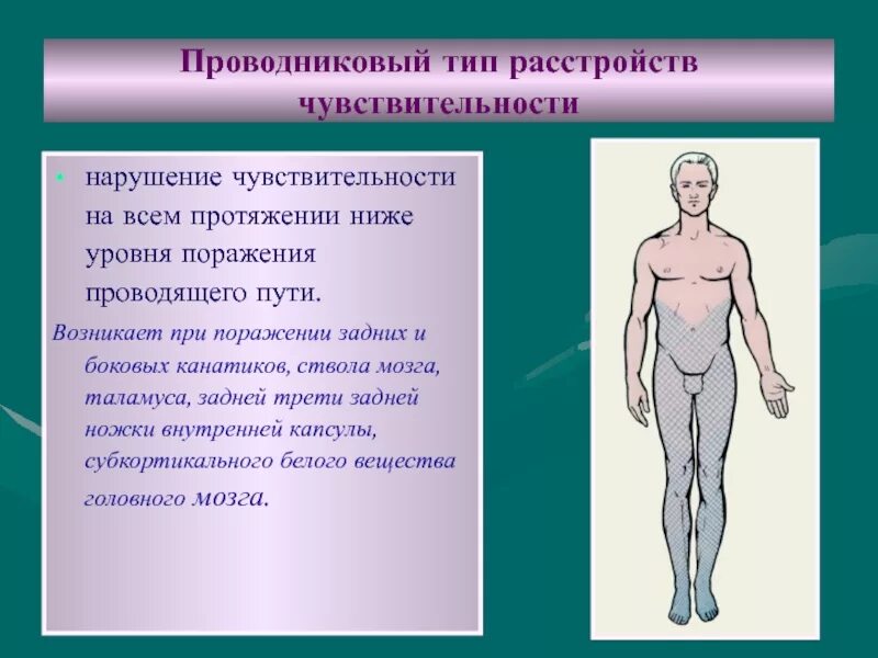 Сегментарный диссоциированный тип расстройства чувствительности. Диссоциированный тип расстройства чувствительности. Синдромы поражения спинного мозга неврология. Симптомы расстройства общей чувствительности. Снижении чувствительности нервов.