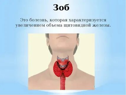 Зоп