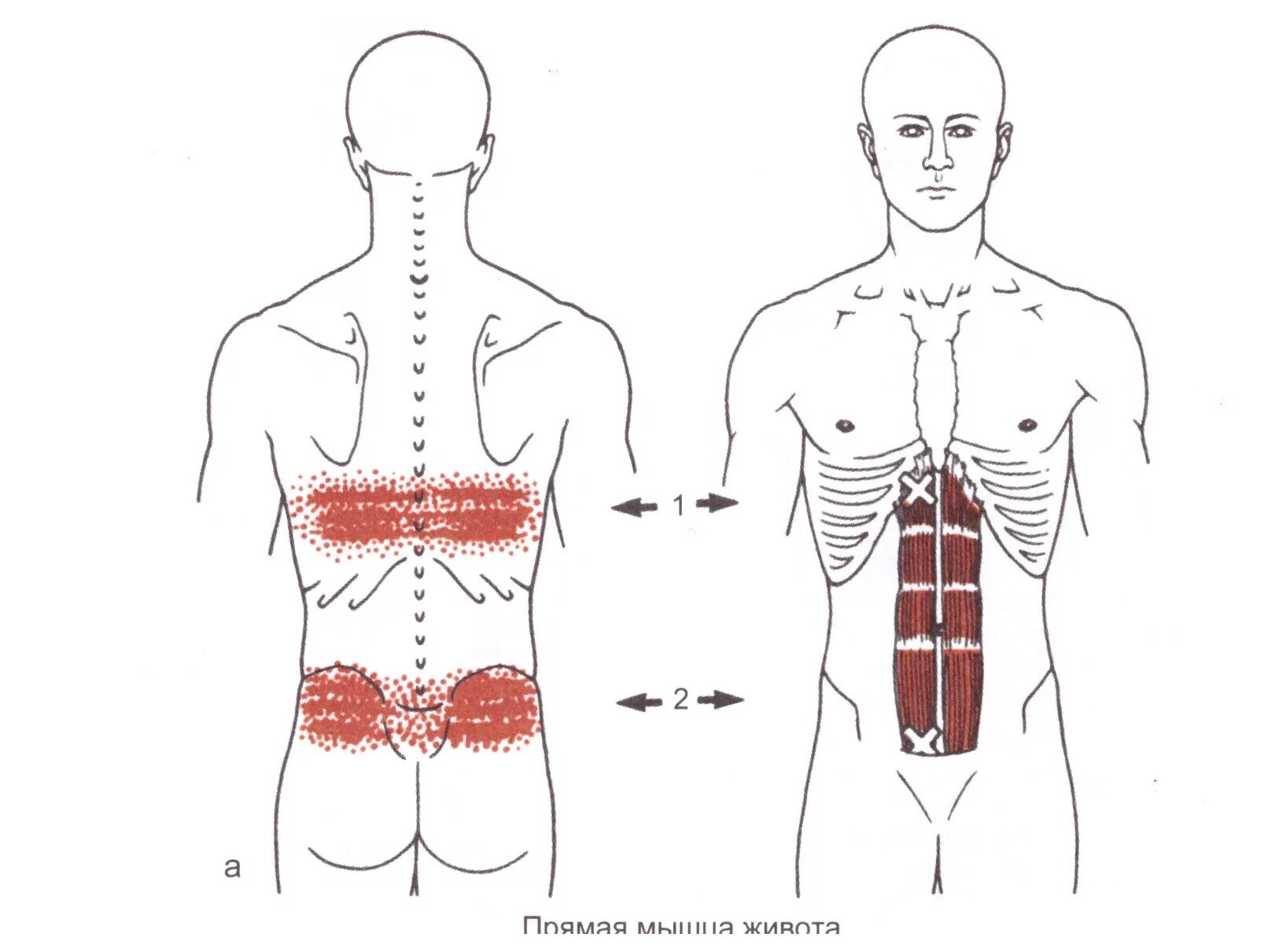 Иррадиация внизу живота. Миофасциальный синдром триггерные точки. Триггерные точки разгибателей спины. Миофасциальные триггерные точки спины. Миофасциальный синдром спина.