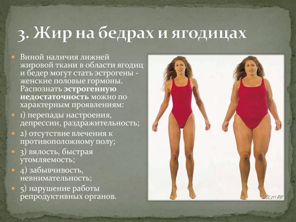 Почему женщины после. Эстрогеновый Тип фигуры у женщин. Типы фигур у женщин ожирение. Гормональный лишний вес у женщин. Эстроген и женская фигура.