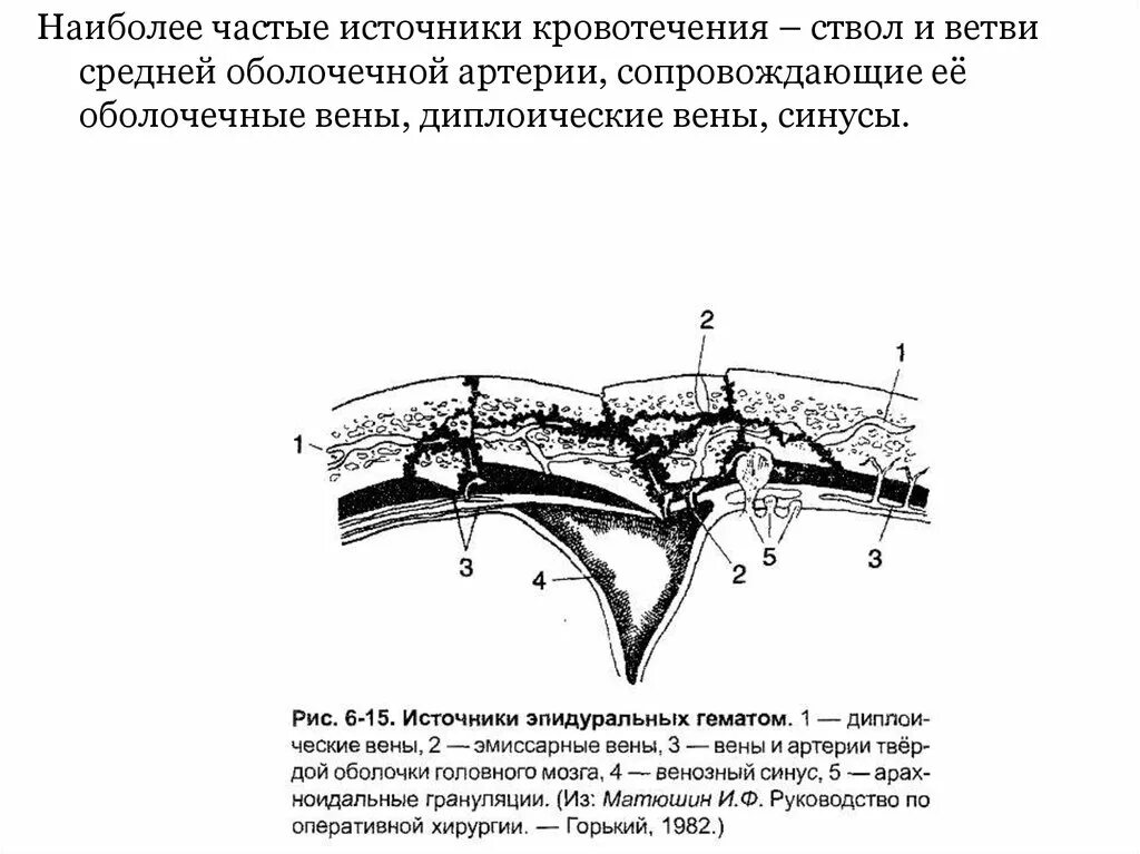 Топография средней оболочечной артерии и её ветвей. Операция при ранениях средней оболочечной артерии. Средняя оболочечная артерия топография. Основной ствол средней оболочечной артерии.