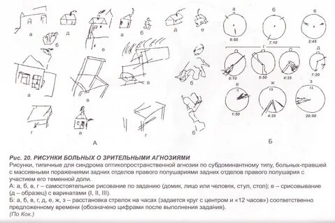 Общий признак зрительной агнозии