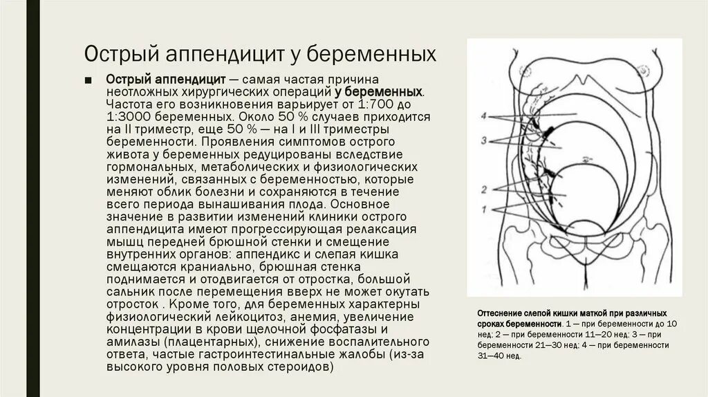 Аппендицит рекомендации. Аппендицит и беременность клинические рекомендации. доступы при аппендэктомии у беременных. беременность при аппендиците специфические симптомы. симптомы аппендицита у беременных.