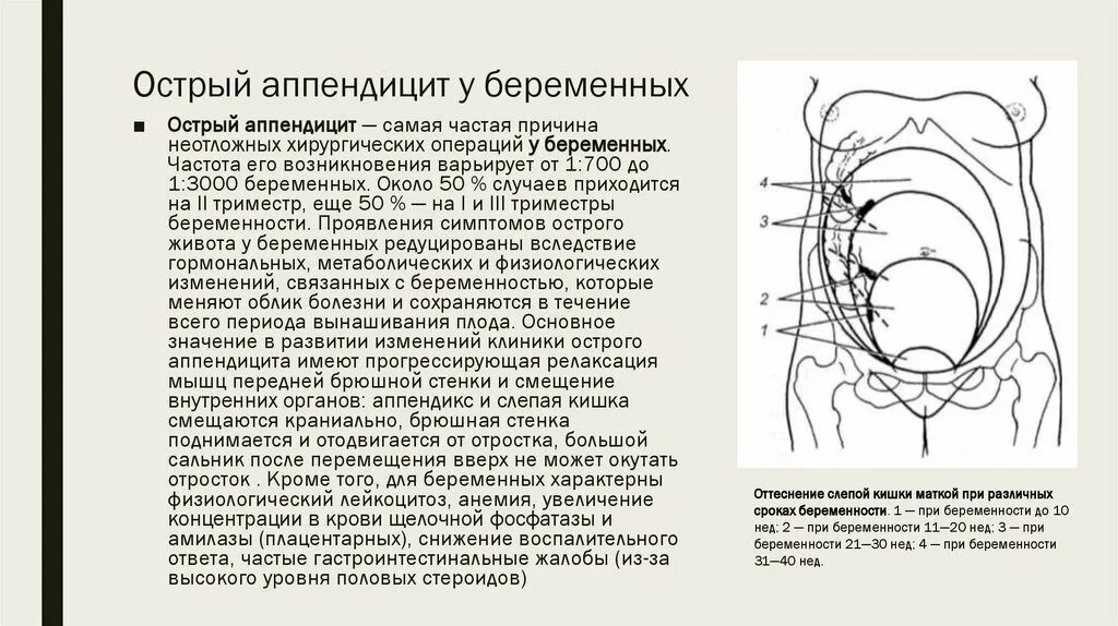 Аппендицит и беременность клинические рекомендации. Доступ при аппендэктомии у беременных. Беременность при аппендиците специфические симптомы. Симптомы аппендицита у беременных.