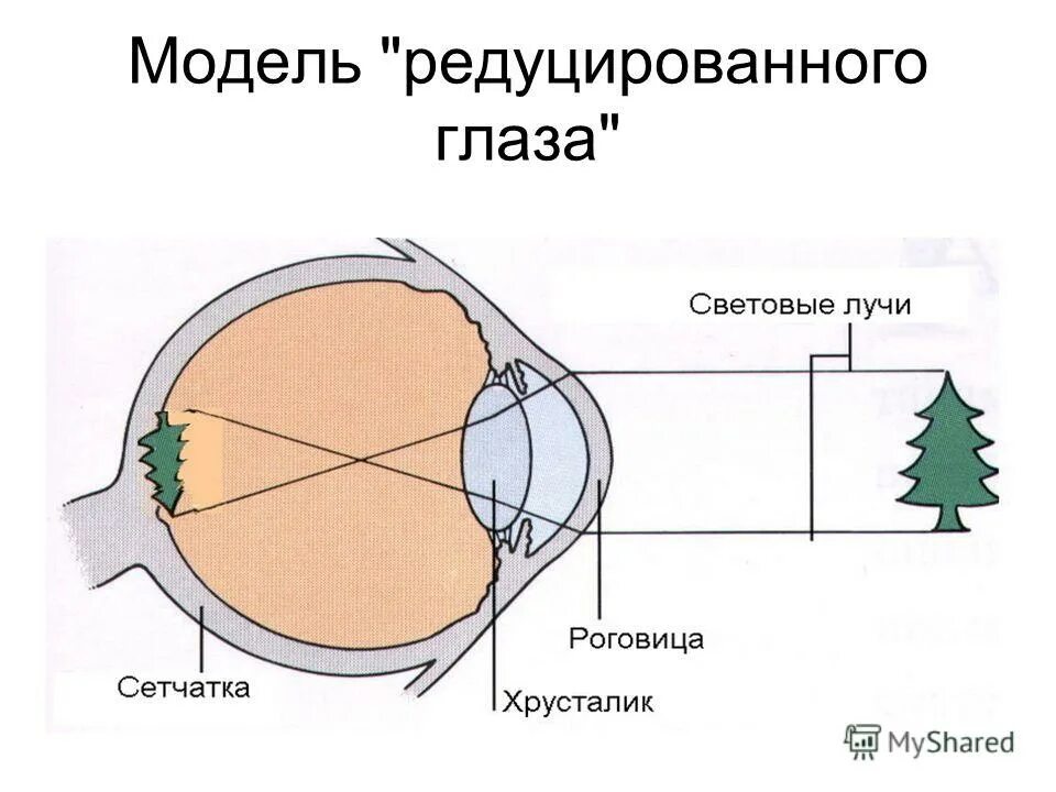 построение изображения на сетчатке. редуцированный глаз по вербицкому. редуцированный глаз составляющие. глаза редуцированы. глаза редуцированы.