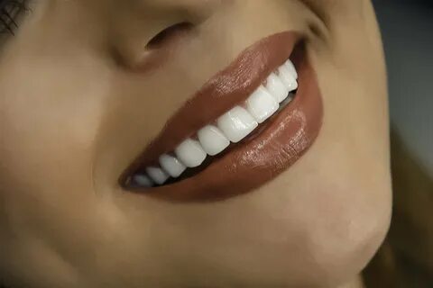 Дизайн улыбки