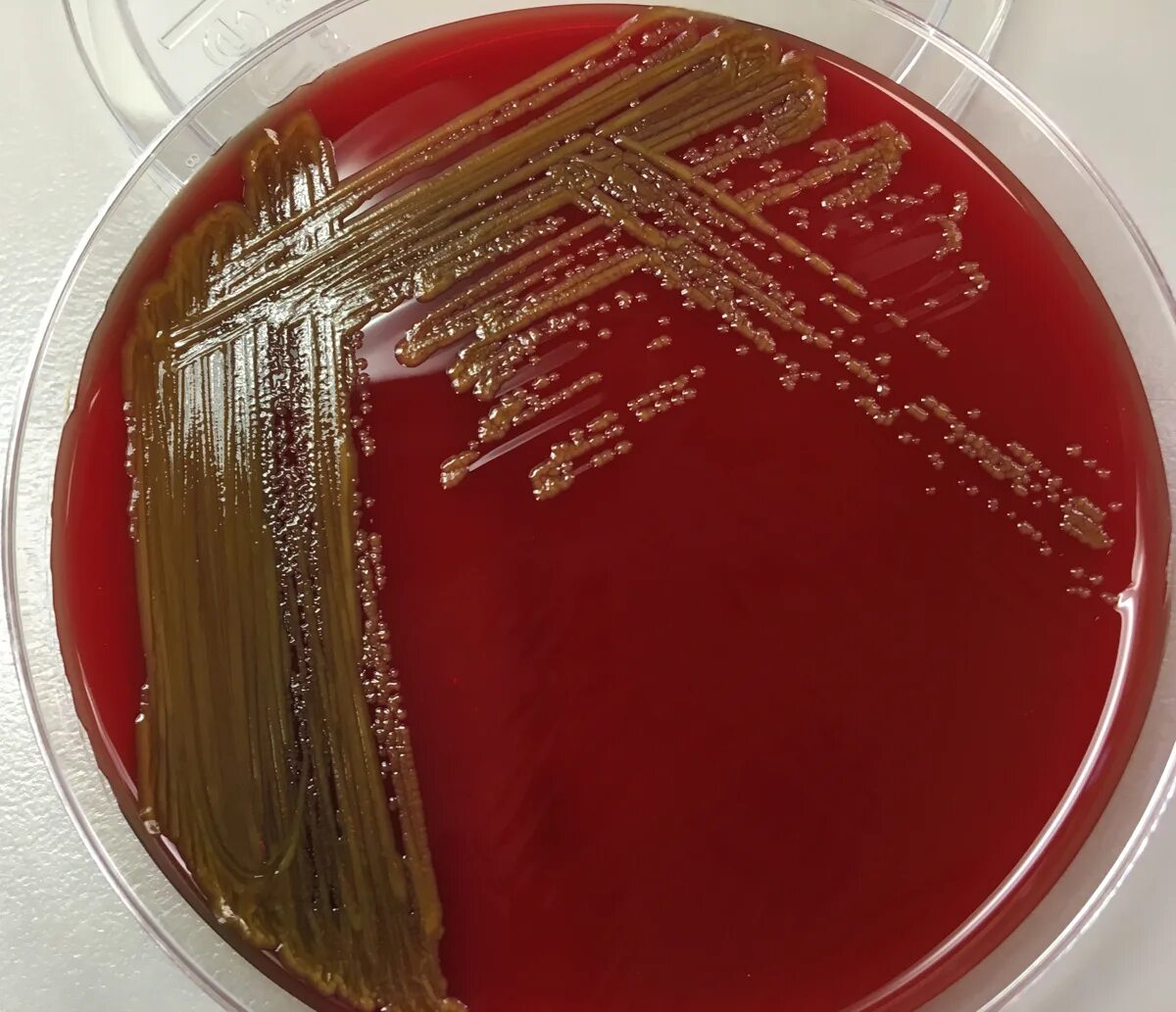 Брюшной тиф агар плоскирева. Дрожжевой осадок в пиве. Осветление агар агаром. Бульон хоттингера. Staphylococcus intermedius на кровяном агаре.