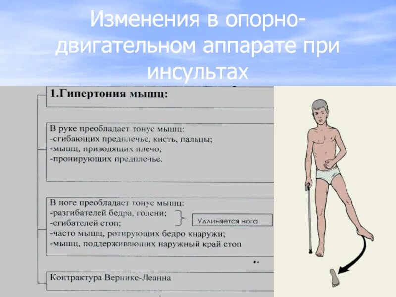 Работа двигательного аппарата. Изменения опорно-двигательного аппарата. возрастные изменения опорно двигательной системы. опорно-двигательный синдромы. изменение опорно двигательного аппарата при старении.
