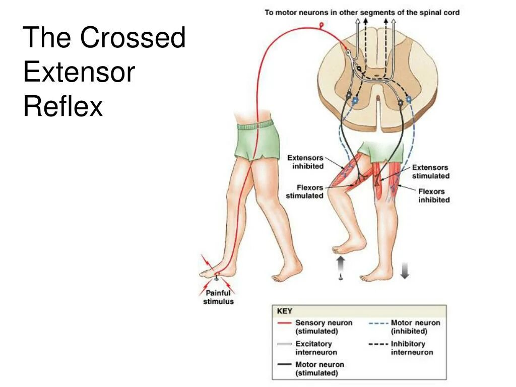 Crossed extensor Reflex. Spinal Cord Reflexes. Crossed extensor Reflex Baby. Reflex Archof the Thoracis segment.