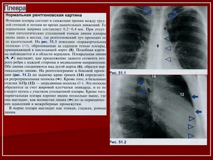 Полоски на легких