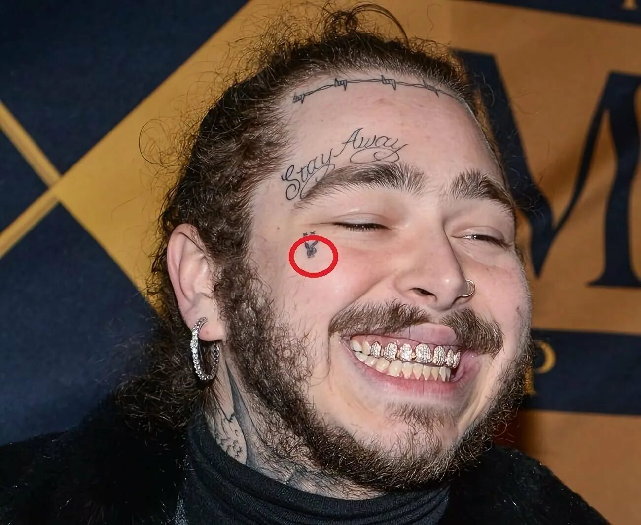 Гранфест с косичками и золотыми зубами. Gucci mane с золотыми зубами. Российский рэпер с золотыми зубами. Певец с золотыми зубами. Asap rocky гриллзы.