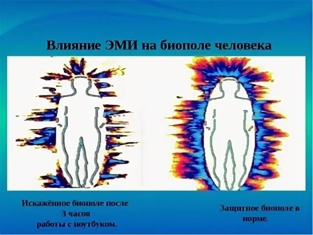 Локальное воздействие постоянного магнитного поля на человека. Электромагнитное поле человека. Биополе человека. Магнитное поле человека. Биополе человека и электромагнитное излучение.