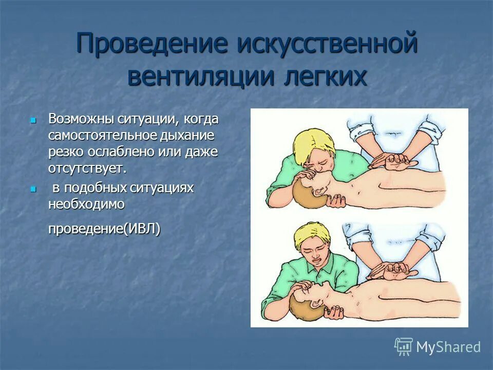 искусственная вентиляци лёгких. искусственная вентиляция легких. исскуственная вентиляция лёгких. искусственная вентиляция легких. искусственная вентиляция лёгких у детей.