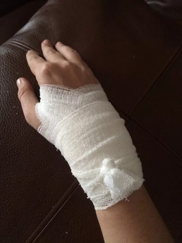 фото перевязанной. фото перевязанной. фото перевязанной. фото перевязанной. фото перевязанной.