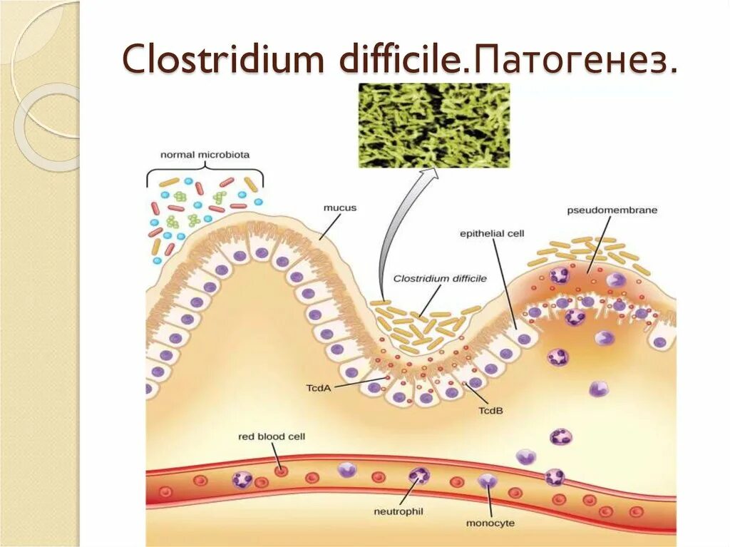 Clostridium difficile что это. Токсин клостридии диффициле. Клостридия диффициле патогенез. Токсины клостридиум диффициле.