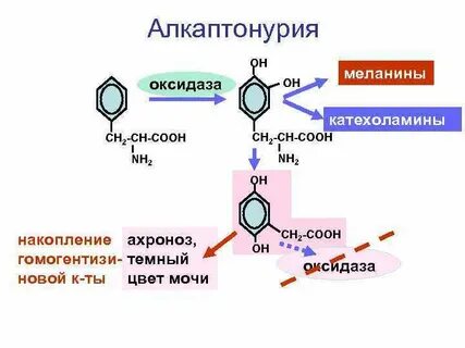 Нарушение обмена тирозина