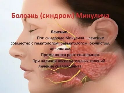 Шегрена владикавказ