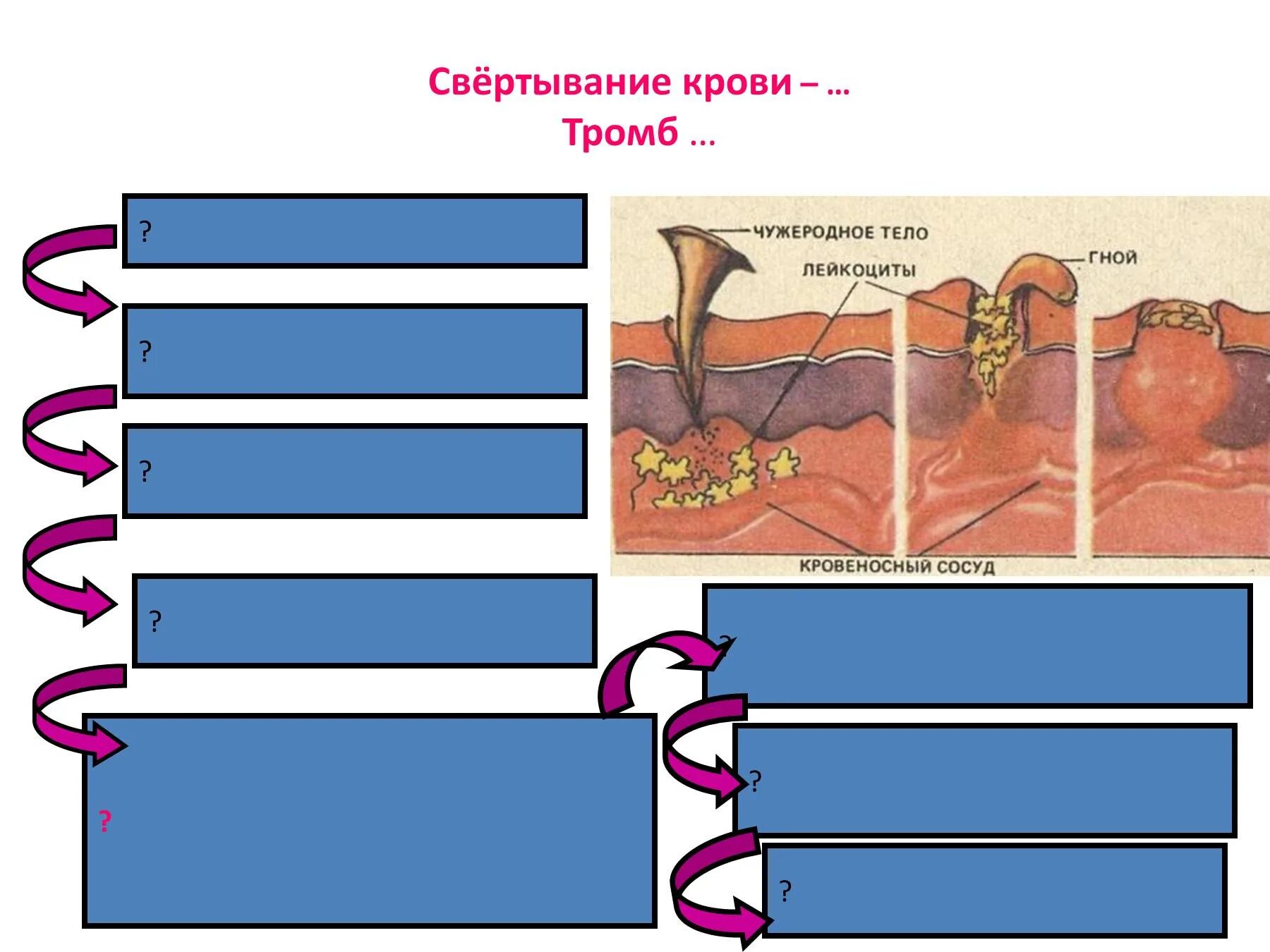 Как изменится количество фибрина после пореза. Схема образования тромба. Схема свертывания крови. Образование тромба последовательность.