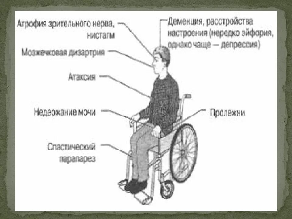 Рассеянный склероз. Рассеянный склероз презентация. Рассеянный склероз слайд. Рассеянный склероз инвалид.