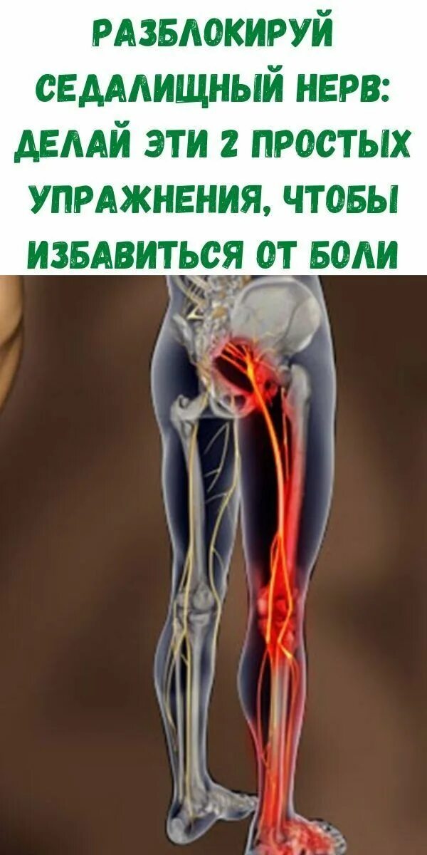 От чего бывает защемление нерва. Седалищный нерв. акупрессура седалищный нерв. защемление седалищного нерва анатомия. разблокирование седалищного нерва.