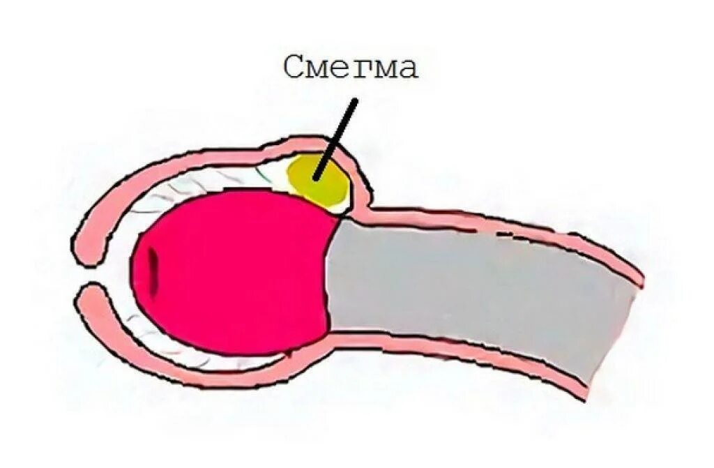 Тип Полового Члена