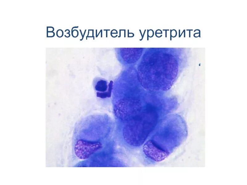 Бактериальный уретрит у мужчин. Возбудителям негонококковых уретритов. возбудитель негонококкового уретрита. возбудитель уретрита у мужчин.