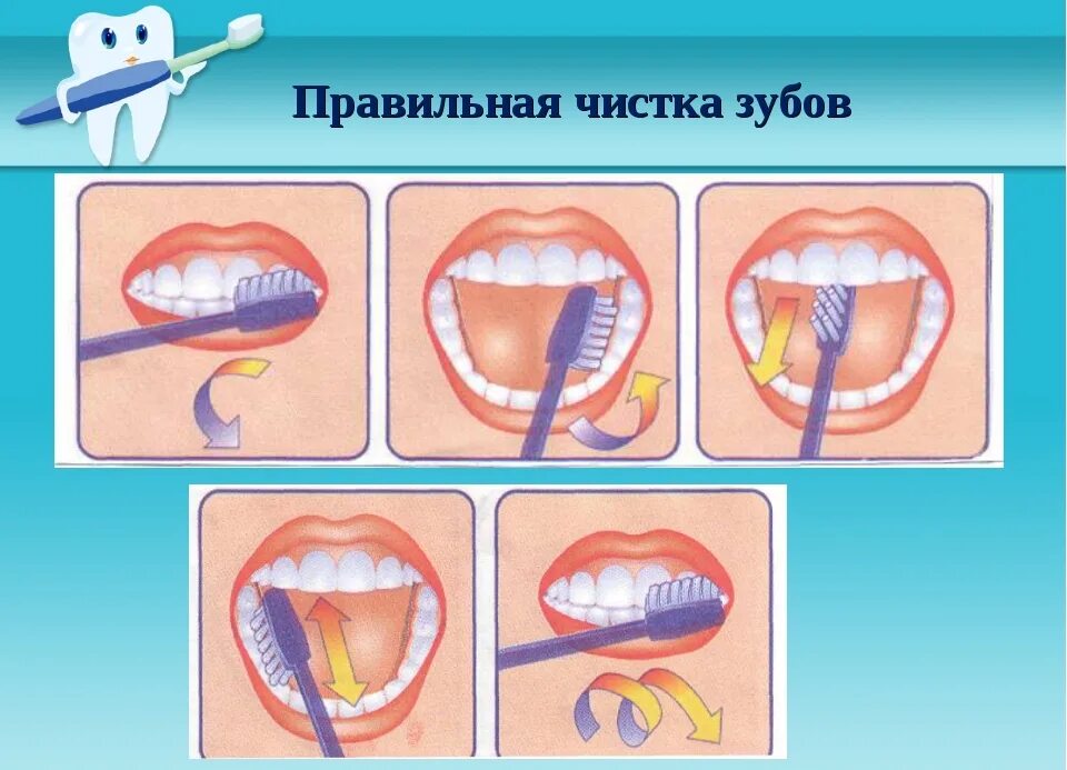 Плюсы чистки зубов. Алгоритм чистки зубов для дошкольников. Схема правильной чистки зубов. Правельна схема чистки зубов. Правильная чистка зубов.